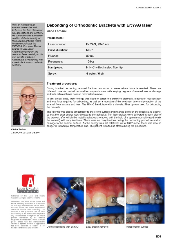 Debonding of Orthodontic Brackets with Er:YAG laser