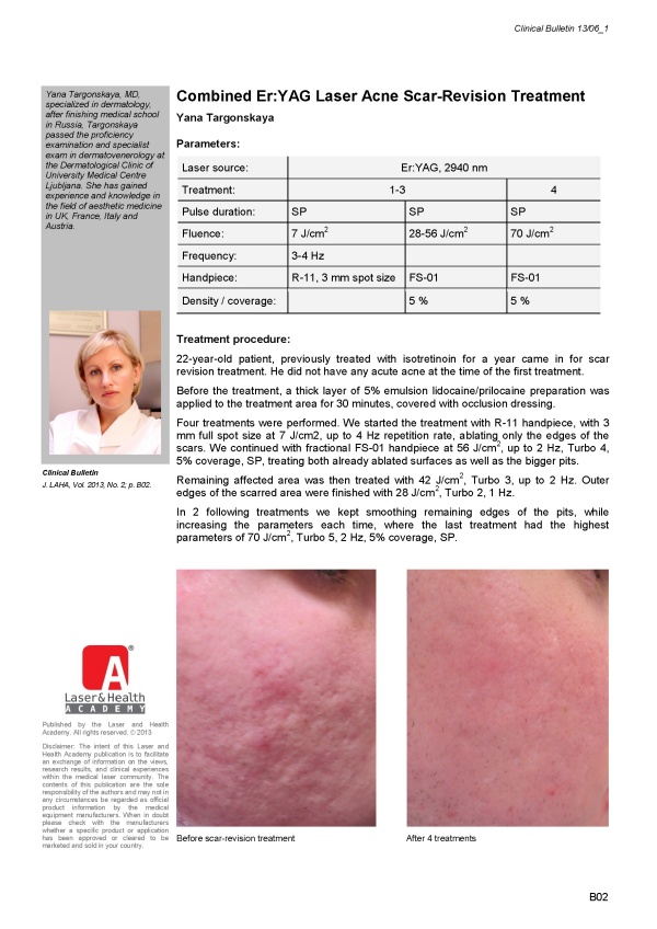 Combined Er:YAG Laser Acne Scar-Revision Treatment